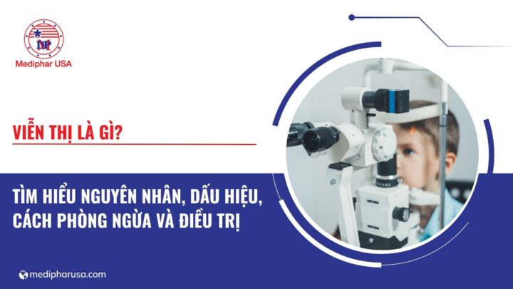 viễn thị là gì