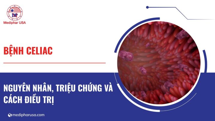Bệnh Celiac