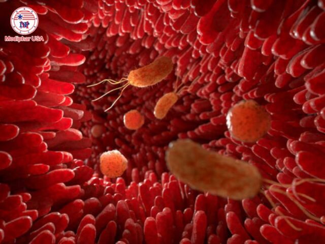 Bệnh Celiac là gì? Nguyên nhân, triệu chứng và cách điều trị Bệnh Celiac là bệnh tự miễn làm tổn thương nhung mao ruột.