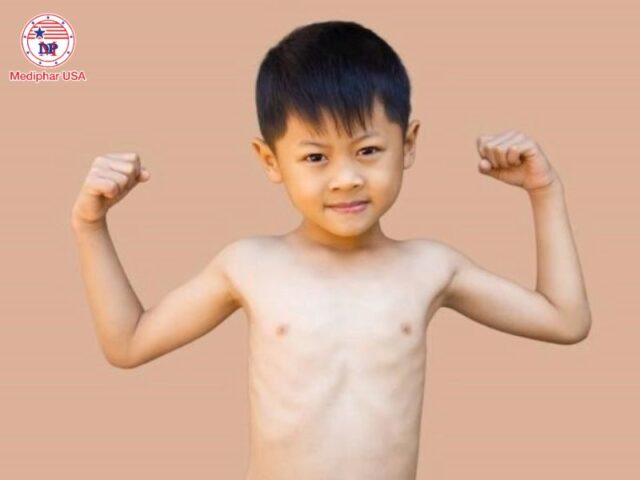 Bệnh Celiac là gì? Nguyên nhân, triệu chứng và cách điều trị Bệnh Celiac có thể gây suy dinh dưỡng, chậm phát triển ở trẻ.