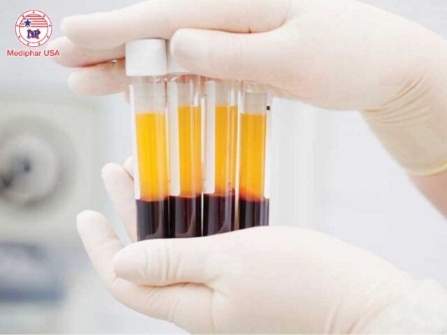 Bệnh Celiac là gì? Nguyên nhân, triệu chứng và cách điều trị Bệnh Celiac có thể chẩn đoán bằng xét nghiệm huyết thanh tìm kháng thể đặc hiệu.