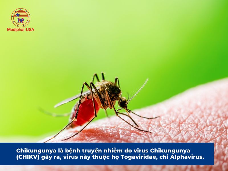 Bệnh chikungunya là gì? Nguyên nhân, triệu chứng, cách phòng ngừa Chikungunya là bệnh truyền nhiễm do virus Chikungunya gây ra