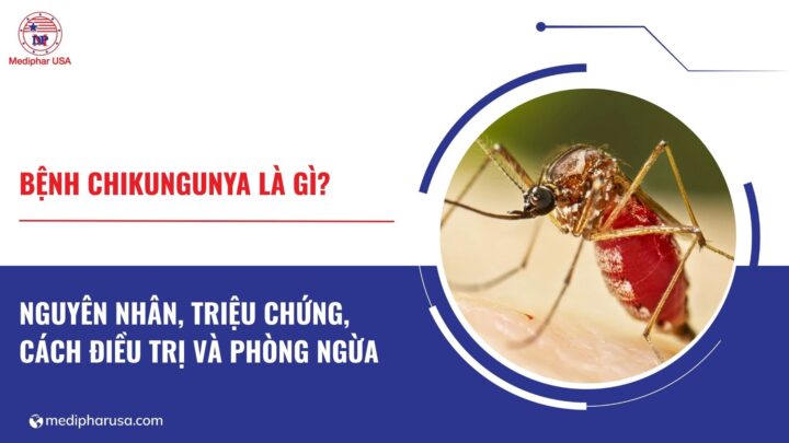 Bệnh chikungunya là gì