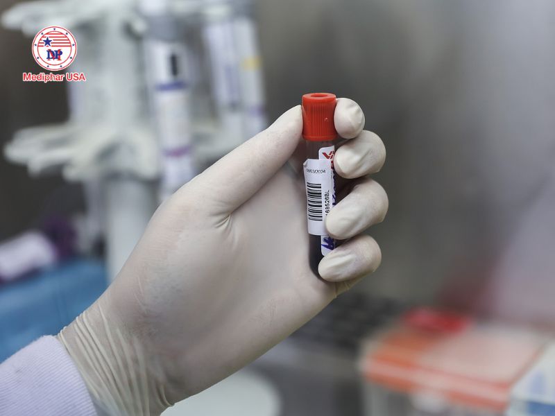 Công nghệ enzyme là gì? Ứng dụng và tiềm năng phát triển trong y dược Ứng dụng enzyme trong xét nghiệm và định lượng các chất sinh học trong máu