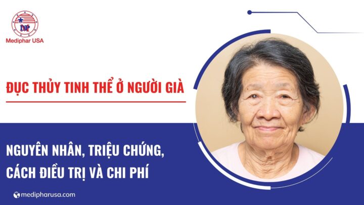 đục thủy tinh thể ở người già