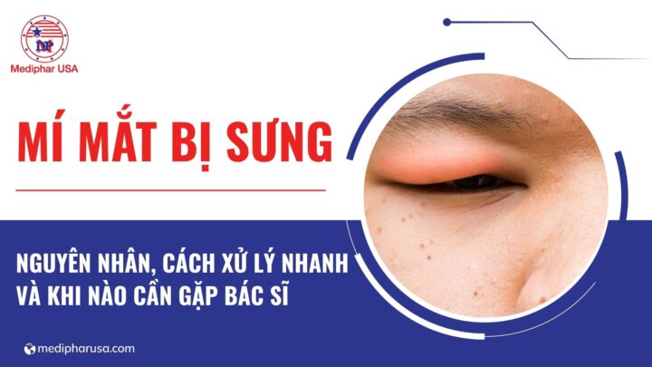 Mí mắt bị sưng: Nguyên nhân, cách xử lý nhanh và khi nào cần gặp bác sĩ