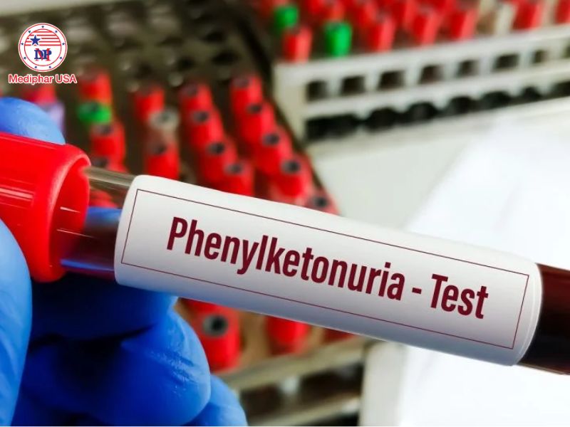 Rối loạn chuyển hóa enzyme: Nguyên nhân, dấu hiệu và phương pháp điều trị Phenylketon niệu là một trong những loại rối loạn chuyển hóa acid amin do thiếu enzyme phenylalanine hydroxylase.