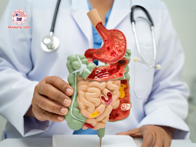 Hỏi đáp: Uống men tiêu hóa hàng ngày có tốt không? Tự ý dùng men tiêu hóa mà không có chỉ định có thể che dấu các bệnh lý tiềm ẩn