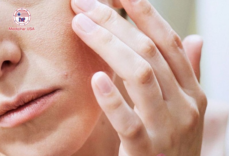 Uống vitamin E như thế nào để đẹp da? Tham khảo hướng dẫn từ chuyên gia Những người có làn da khô nên sử dụng loại vitamin này