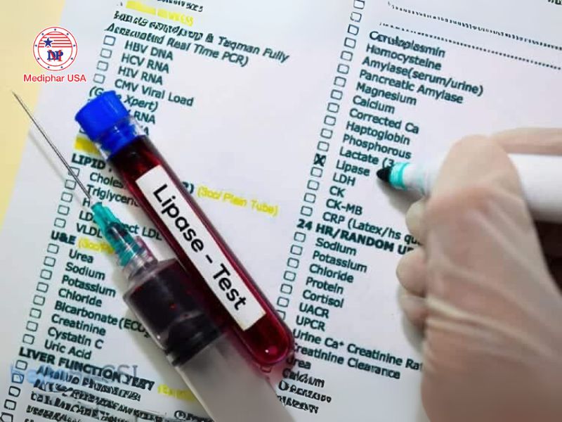 Lipase là gì? Vai trò, cơ chế hoạt động và ứng dụng thực tiễn Chỉ số lipase ở người trưởng thành bình thường nằm trong khoảng 0 - 160 U/L