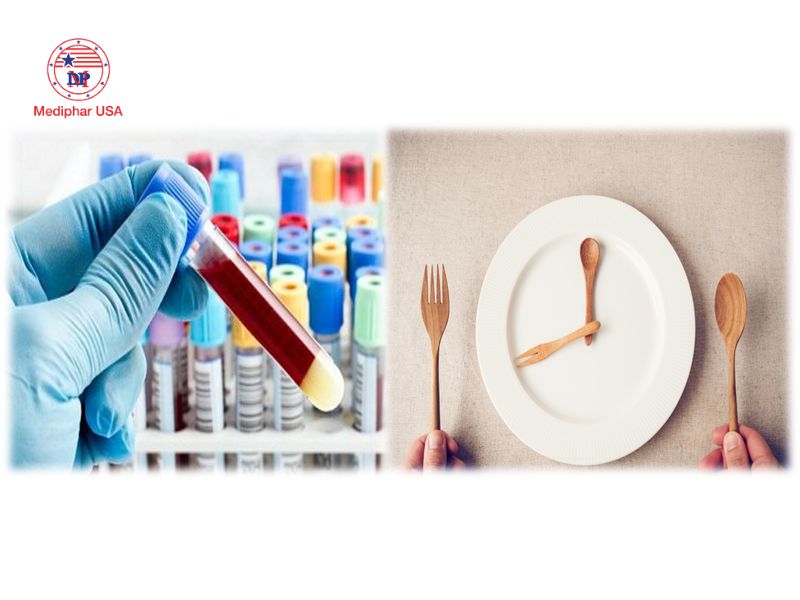 Lipase là gì? Vai trò, cơ chế hoạt động và ứng dụng thực tiễn Cần nhịn ăn trước xét nghiệm ít nhất 8-12 tiếng