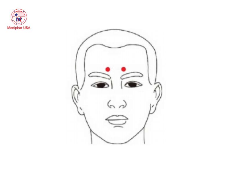 7 huyệt bấm giúp giảm khô mắt, mỏi mắt và làm sáng mắt Huyệt Ngư Yêu nằm ở chính giữa cung lông mày