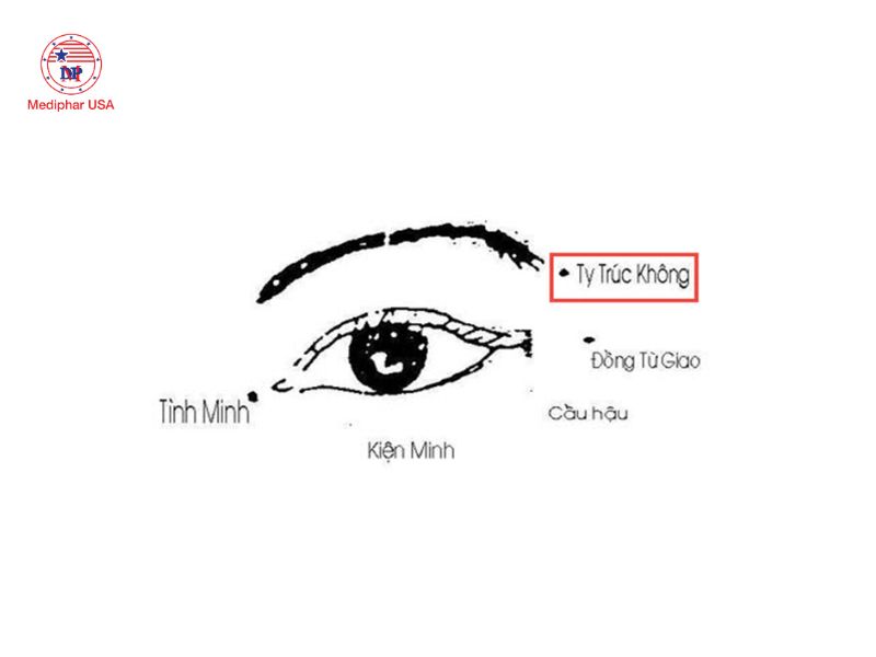 7 huyệt bấm giúp giảm khô mắt, mỏi mắt và làm sáng mắt Huyệt Ty Trúc Không nằm ở chỗ lõm ngay phía ngoài đuôi lông mày