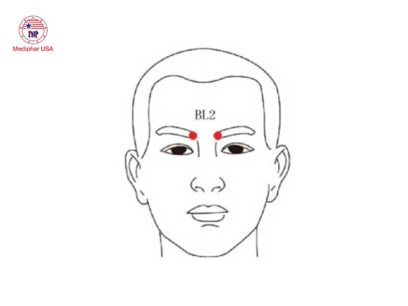 7 huyệt bấm giúp giảm khô mắt, mỏi mắt và làm sáng mắt Huyệt Toản Trúc nằm ở vị trí chỗ lõm đầu trong của cung lông mày