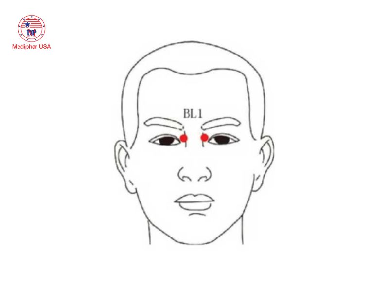 7 huyệt bấm giúp giảm khô mắt, mỏi mắt và làm sáng mắt Huyệt Tinh Minh nằm ở vị trí gần góc mắt trong