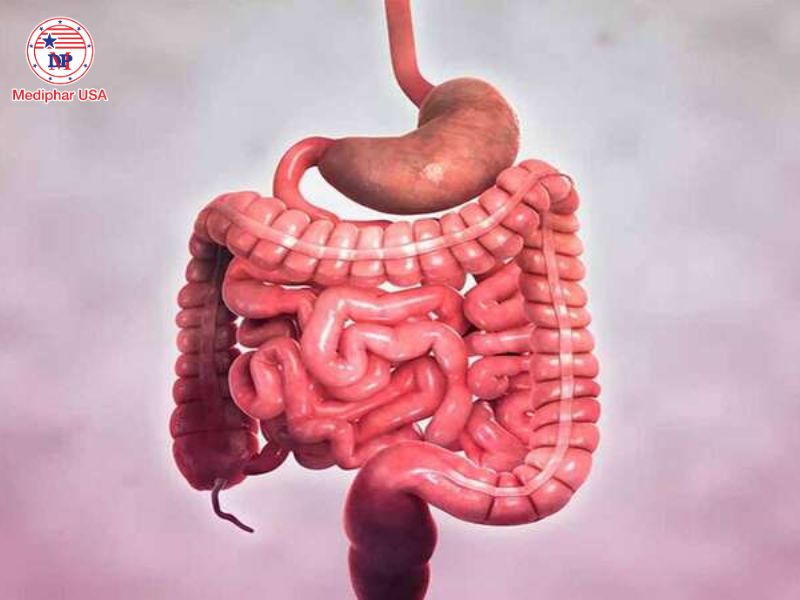 Bệnh Crohn là gì? Tìm hiểu nguyên nhân, triệu chứng và cách điều trị Bệnh Crohn không gây tử vong nếu điều trị và kiểm soát bệnh tốt.