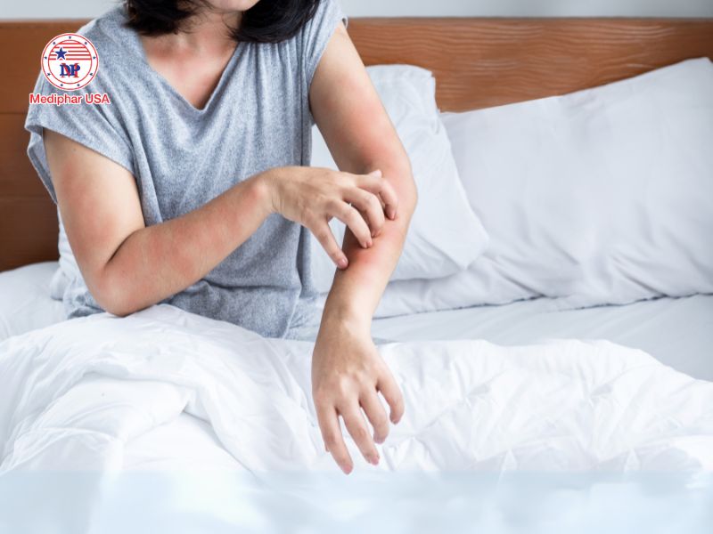 Enzyme lactase là gì? Vai trò, cách bổ sung và lưu ý quan trọng Tác dụng phụ có thể gặp khi dùng lactase là phản ứng dị ứng