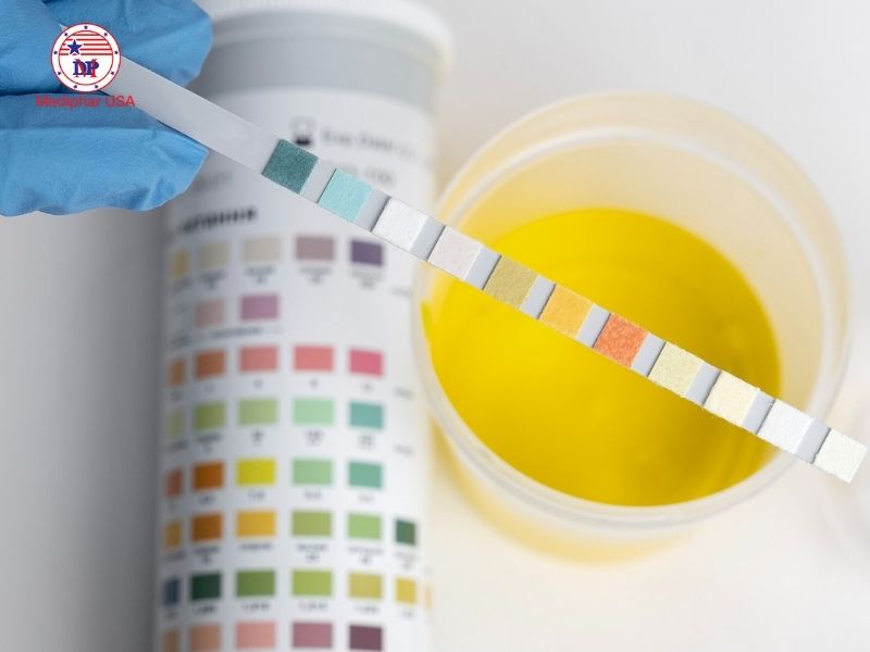 Sụt cân không rõ nguyên nhân: Do đâu và khi nào cần đi khám? Bác sĩ có thể chỉ định xét nghiệm máu, xét nghiệm nước tiểu, chẩn đoán hình ảnh,... để kết luận nguyên nhân gây sụt cân