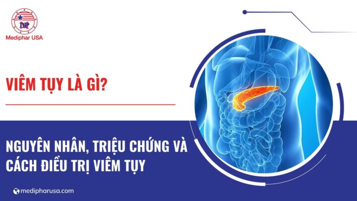 Viêm tụy là gì? Nguyên nhân, triệu chứng và cách điều trị viêm tụy