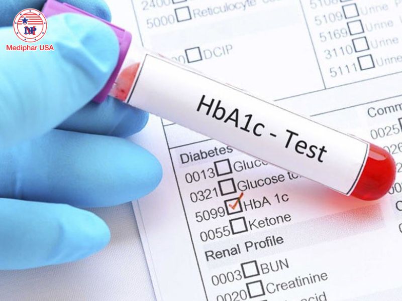 Bệnh tiểu đường là gì? Nguyên nhân, triệu chứng và cách điều trị Xét nghiệm HbA1c phản ánh lượng đường trong ba tháng vừa qua.