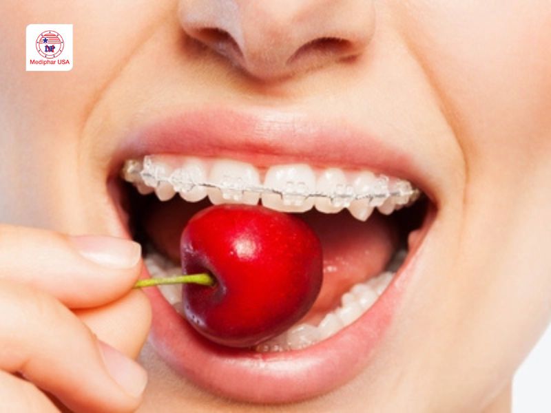 Đường Xylitol là gì? Công dụng, lợi ích là lưu ý khi sử dụng Sử dụng đường Xylitol tốt cho sức khỏe răng miệng