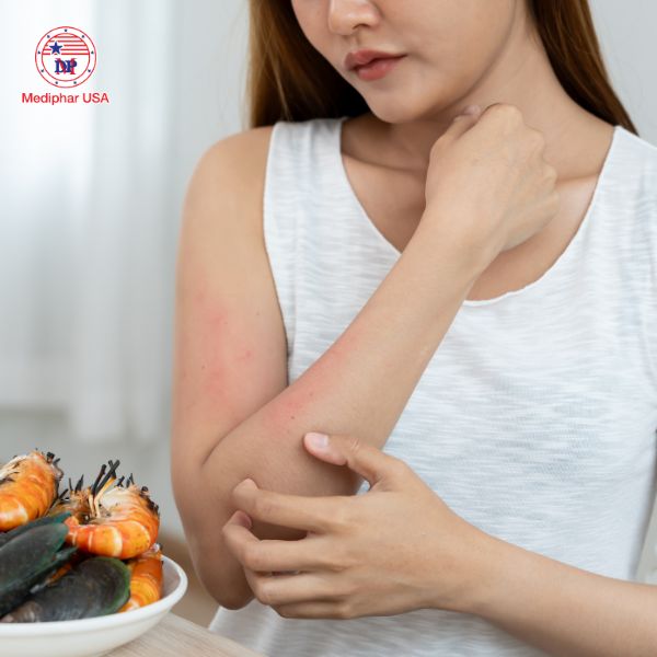 Người dị ứng hải sản nên chọn sản phẩm Omega-3 có nguồn gốc thực vật