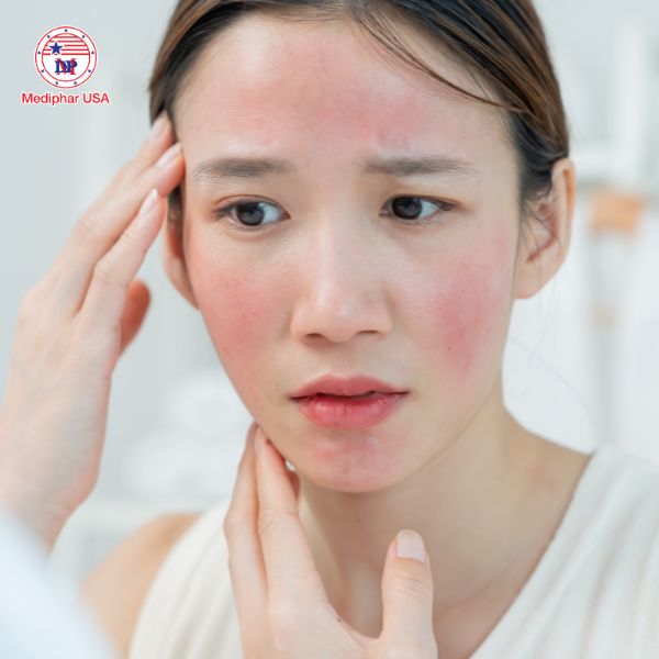 Cần tham khảo ý kiến bác sĩ khi sử dụng Omega 3 với người bị dị ứng hải sản