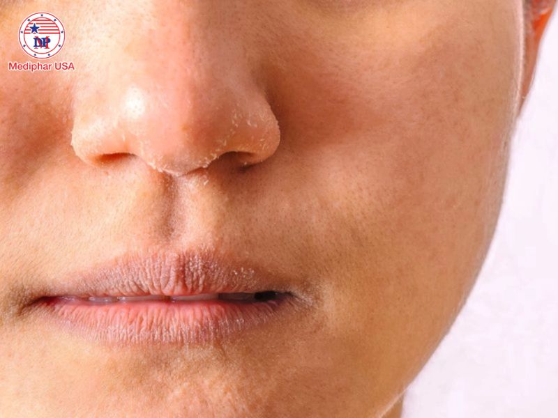 Da khô, môi khô là dấu hiệu của việc mất nước.