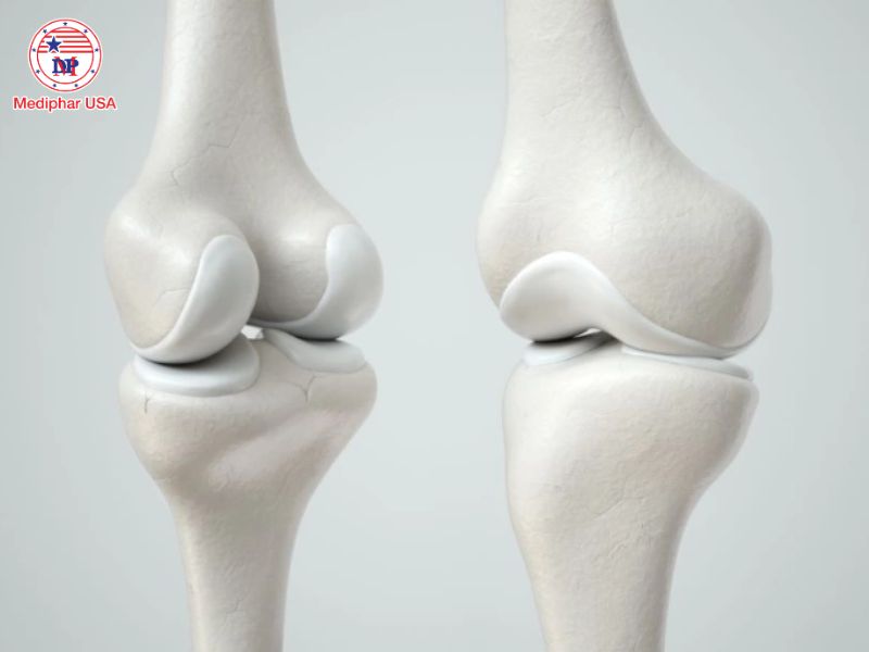 Glucosamine kích thích tế bào sụn tăng sản xuất các chất nền sụn, làm chậm quá trình thoái hóa.