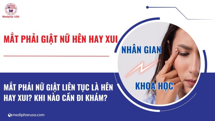 Mắt phải nữ giật liên tục là hên hay xui? Khi nào cần đi khám?