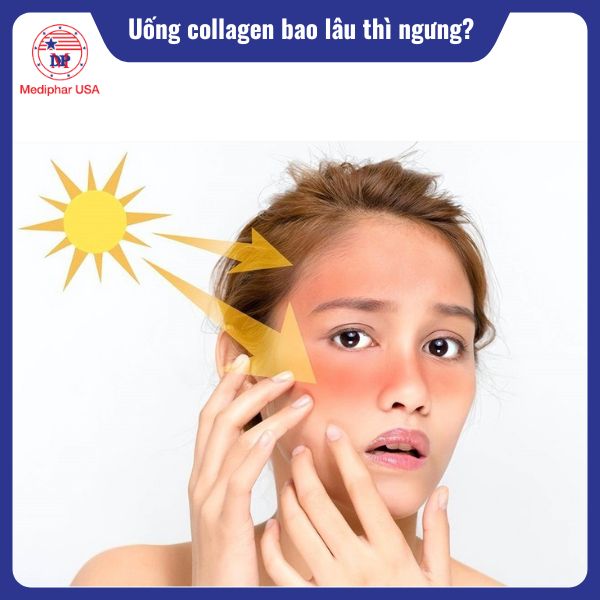 Uống collagen bao lâu thì ngưng? Hướng dẫn thời gian và liệu trình giúp tối ưu hiệu quả Bảo vệ da khỏi ánh nắng mặt trời là điều quan trọng nhất