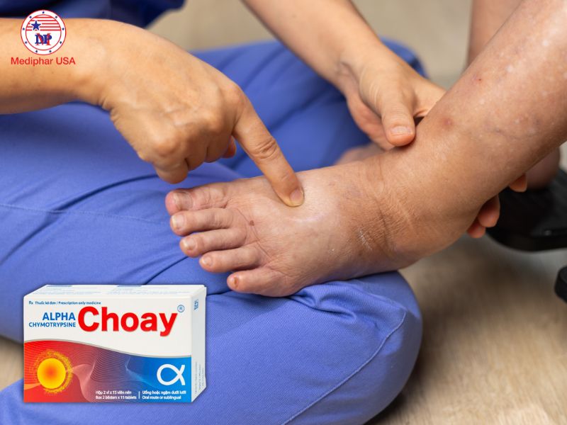 Alpha Choay được sử dụng để kháng viêm, giảm phù nề