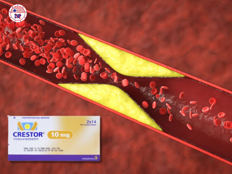 Crestor 10mg là thuốc điều trị rối loạn lipid máu thường được bác sĩ chỉ định nhằm giảm cholesterol