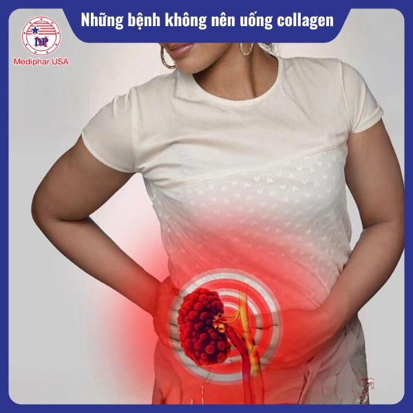 Người mắc bệnh thận mãn tính