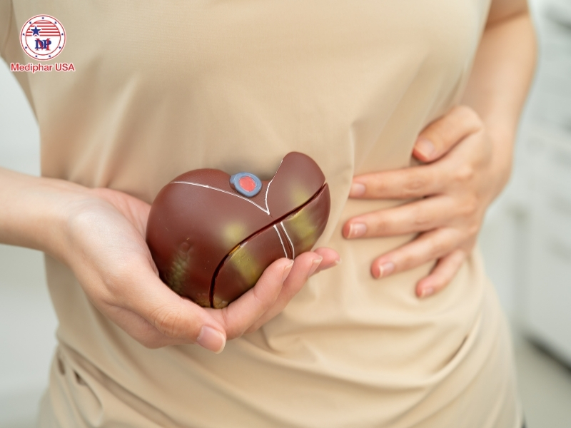 giải độc gan bằng phương pháp dân gian​