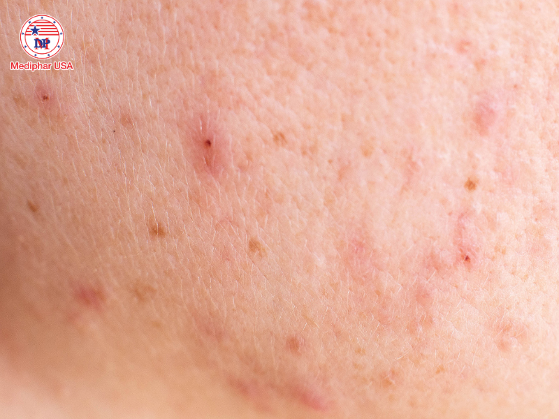 biểu hiện sau khi uống thuốc giải độc gan​ thường gặp