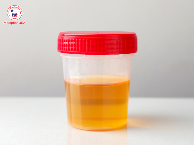 biểu hiện sau khi uống thuốc giải độc gan​ thường gặp