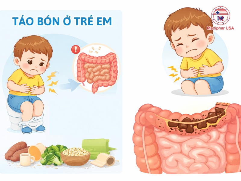 Táo bón ở trẻ là tình trạng rối loạn tiêu hóa khiến việc đi ngoài trở nên khó khăn hơn bình thường