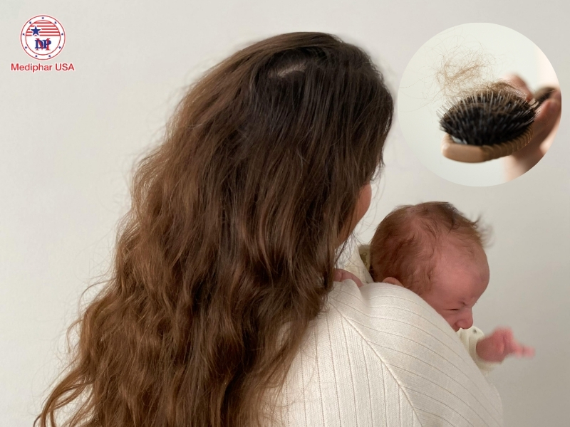 Rụng tóc sau sinh bao lâu thì hết​? 