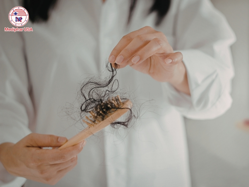 Rụng tóc sau sinh bao lâu thì hết​? 