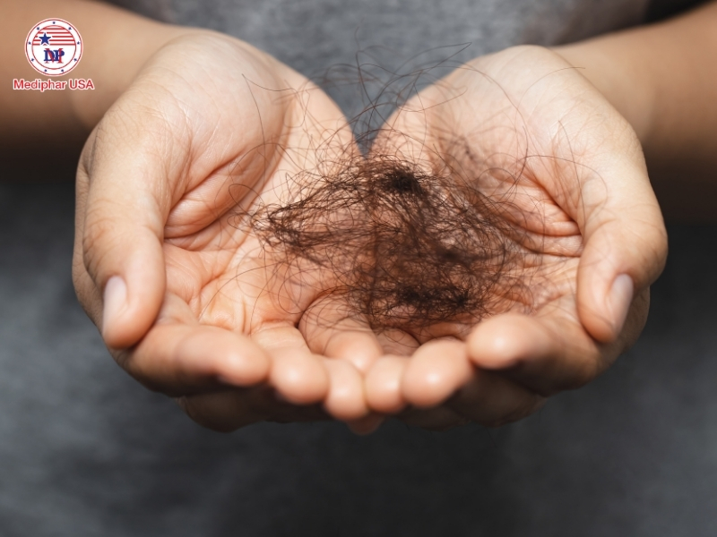 Rụng tóc sau sinh bao lâu thì hết​? 