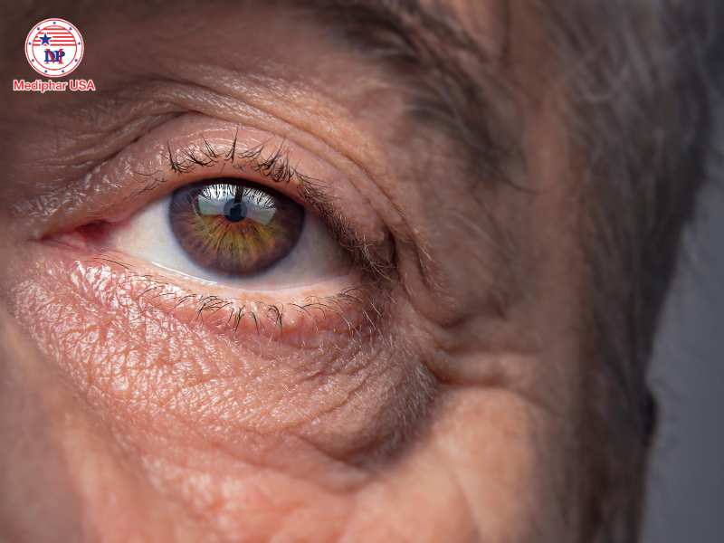 Dầu gấc có tác dụng gì cho mắt?