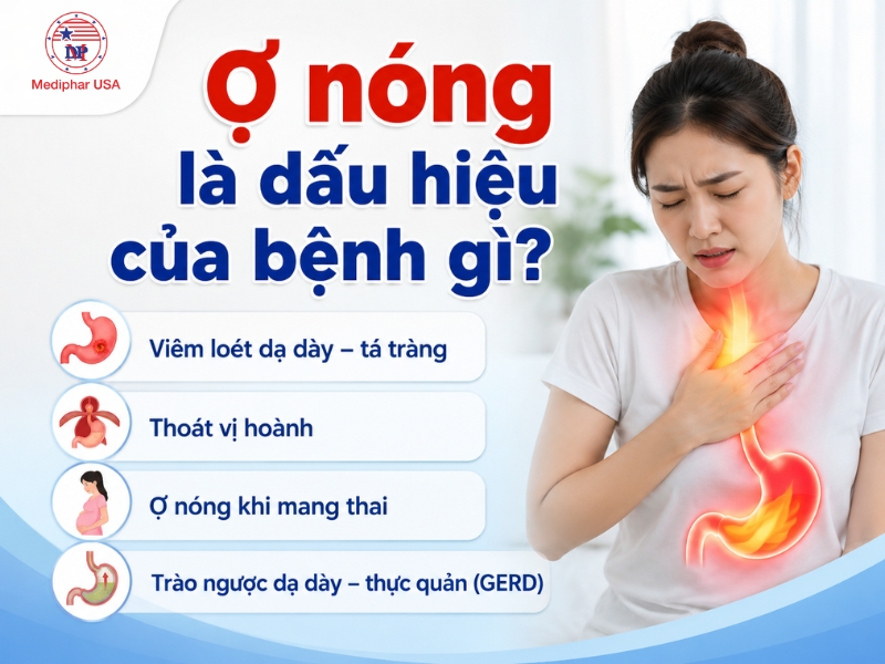 Ợ nóng là gì? Nguyên nhân, triệu chứng và cách xử trí tại nhà Ợ nóng là triệu chứng của một số bệnh tiêu hoá