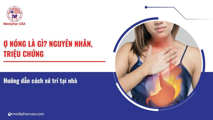 Ợ nóng là gì? Nguyên nhân, triệu chứng và cách xử trí tại nhà