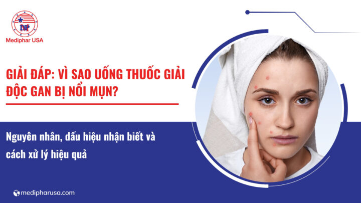Uống thuốc giải độc gan bị nổi mụn: nguyên nhân, dấu hiệu nhận biết và cách xử lý hiệu quả