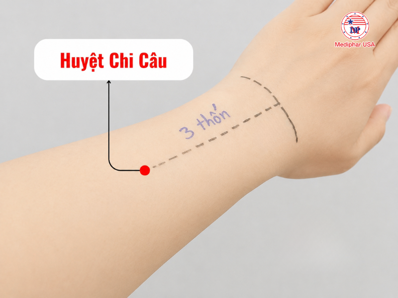 Huyệt Chi Câu (SJ6)